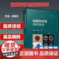 脑膜转移癌病例荟萃 9787309169928 无 复旦大学有限公司