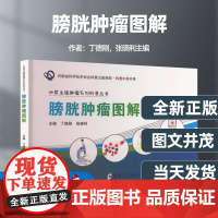 膀胱肿瘤图解丁德刚张晓利编肿瘤学生活正版图书籍郑州大学出版社膀胱肿瘤流行病学诊断技术治疗策略围术后随访膀胱灌注