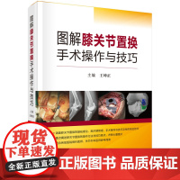 图解膝关节置换手术操作与技巧王坤正科学出版社9787030616418医学卫生/外科学