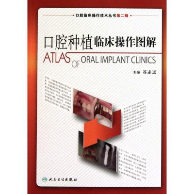 [M]口腔种植临床操作图解(口腔临床操作技术丛书)-9787117129831
