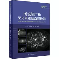 [M]图说超广角荧光素眼底血管造影-9787117314510
