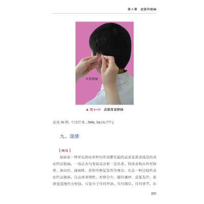 [M]图解刺血疗法-9787504692658