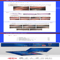[M]放大内镜胃早癌诊治集锦-9787309158328