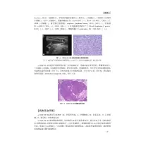 [M]淋巴瘤病例集锦 2022-9787830053918