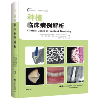 [M]种植临床病例解析-9787559109736