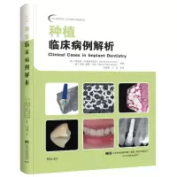[M]种植临床病例解析-9787559109736