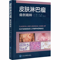 [M]皮肤淋巴瘤病例精粹-9787565927072