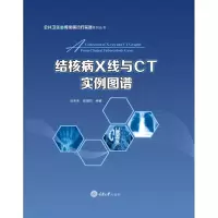 [M]结核病X线与CT实例图谱-9787568909198