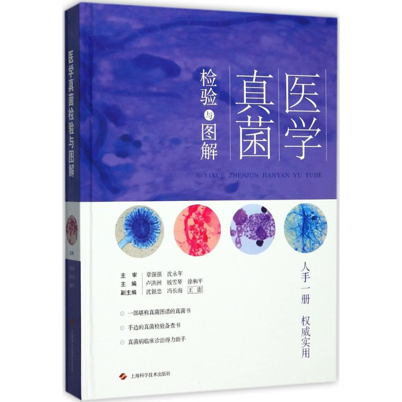 医学真菌检验与图解 卢洪洲,钱雪琴,徐和平 主编 著 生活 文轩网