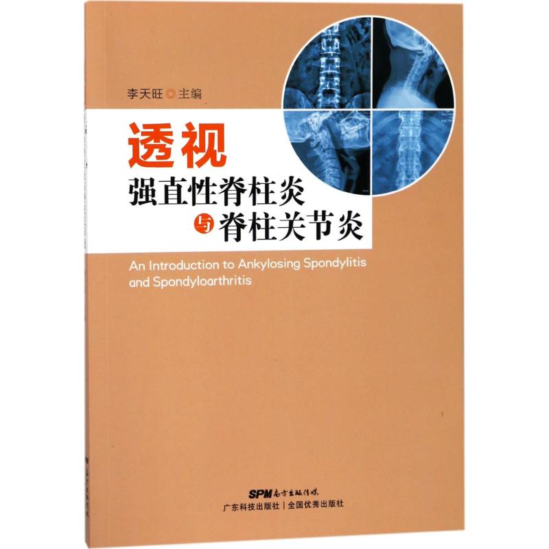 透视强直性脊柱炎与脊柱关节炎 李天旺 主编 生活 文轩网