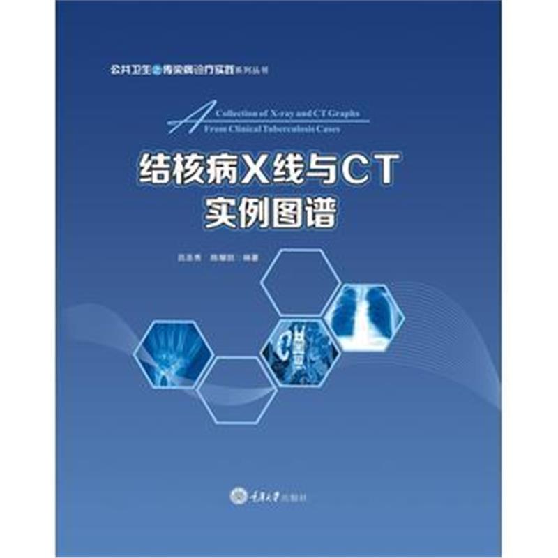 正版书籍 结核病X线与CT实例图谱 9787568909198 重庆大学出版社