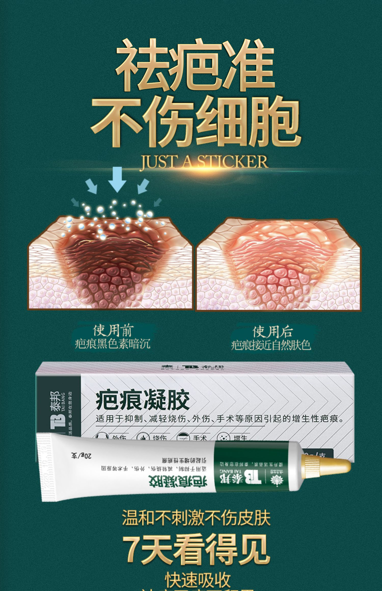 云南白药泰邦疤痕膏祛疤膏去疤痕修复凝胶贴脸部烫伤手术增生伤疤除疤