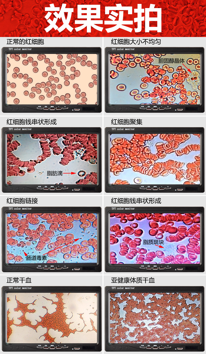 显微镜血液粘稠度图片图片