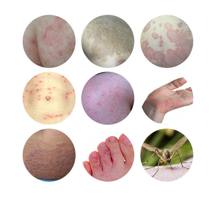 二送一江西鸿海舒立嘉毒霸天下本乳膏软膏止痒独霸天下乳膏