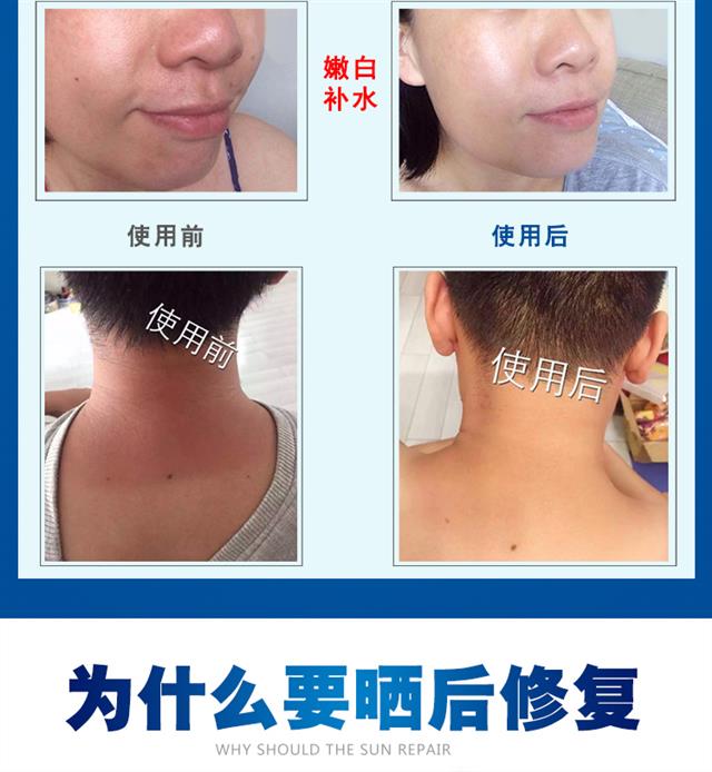 九叶草晒伤膏晒后修复霜舒缓修复乳军训面部肌