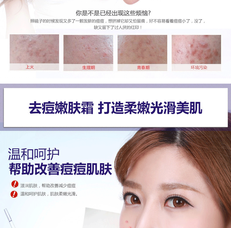 0元_泊泉雅bioaqua去痘膏去除粉刺补水保湿 祛痘膏控油滋养面部精华