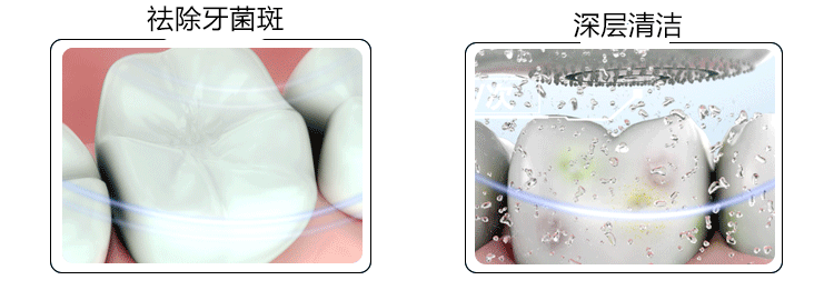 小丑joker电动牙刷a1超声波口腔护理仪智能牙刷全身防水感应充电成人